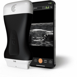 L15 HD3 - Lineal de Alta Frecuencia Sanro Electromedicina