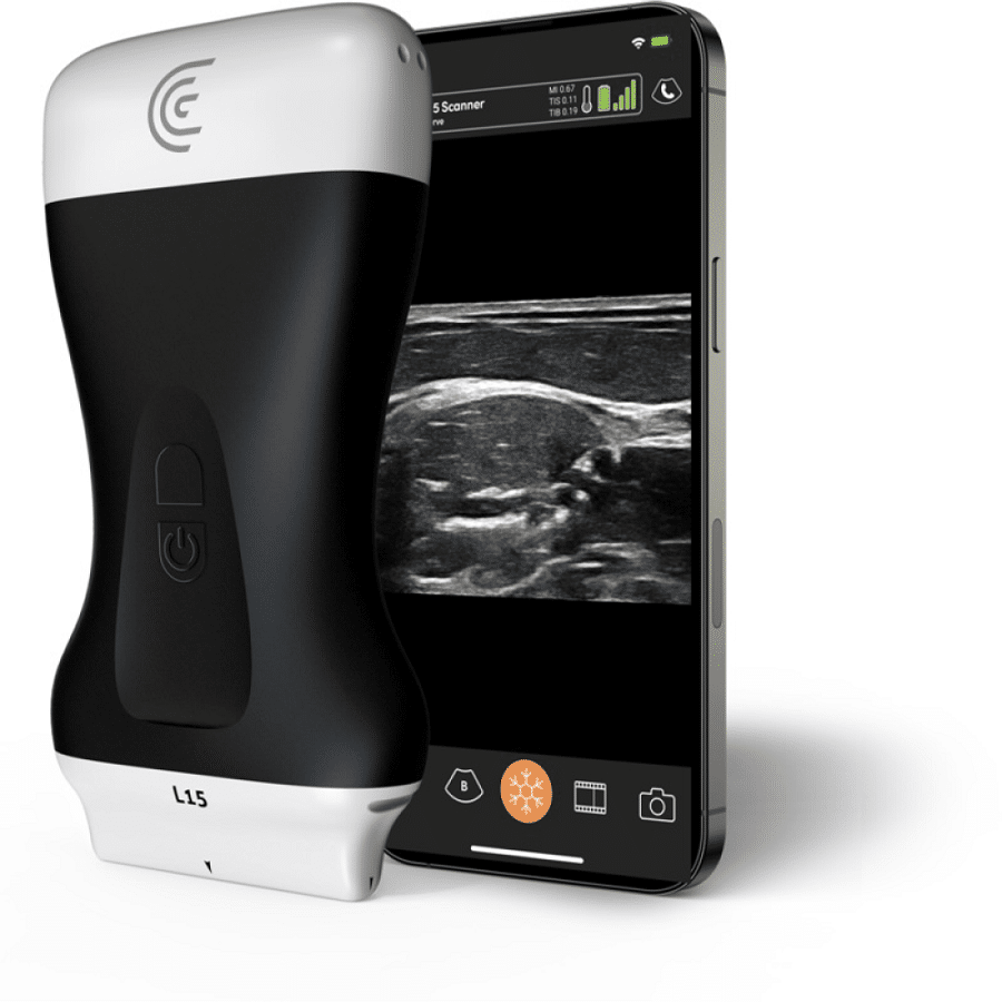 L15 HD3 - Lineal de Alta Frecuencia Sanro Electromedicina