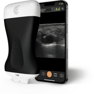 Sanro Electromedicina L20 HD3 - Lineal de Ultra Alta Frecuencia